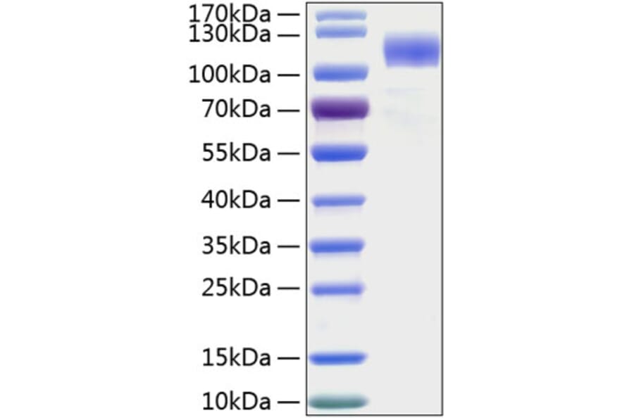 SDS-PAGE - Recombinant Human SIGLEC5 Protein (C-terminal Human Fc and His Tag) (A331265) - Antibodies.com