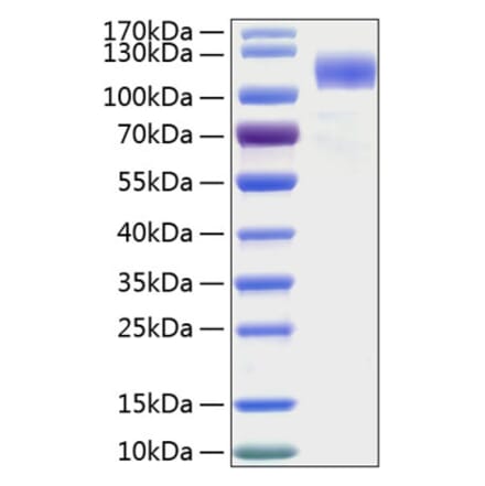 SDS-PAGE - Recombinant Human SIGLEC5 Protein (C-terminal Human Fc and His Tag) (A331265) - Antibodies.com