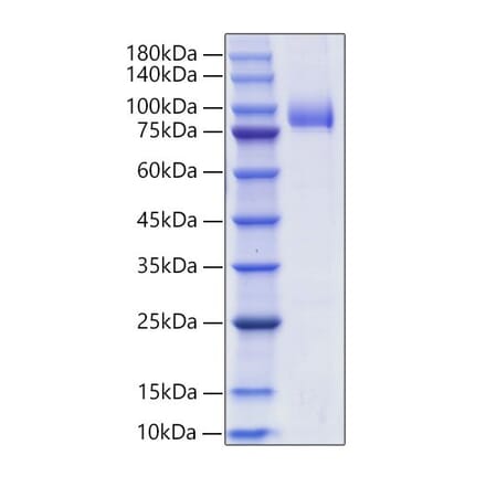 SDS-PAGE - Recombinant Human SIGLEC6 Protein (C-terminal Human Fc and His Tag) (A331266) - Antibodies.com