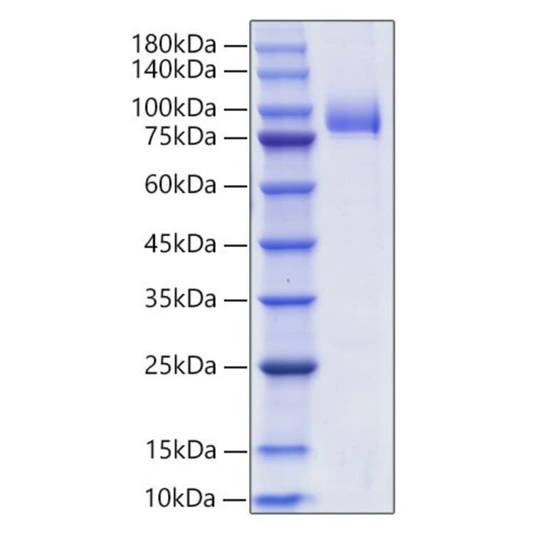 SDS-PAGE - Recombinant Human SIGLEC6 Protein (C-terminal Human Fc and His Tag) (A331266) - Antibodies.com