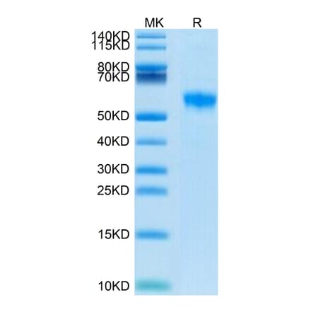 Tris-Bis PAGE - Recombinant Human SIGLEC8 Protein (Biotin) (C-terminal His and Avi Tag) (A331267) - Antibodies.com