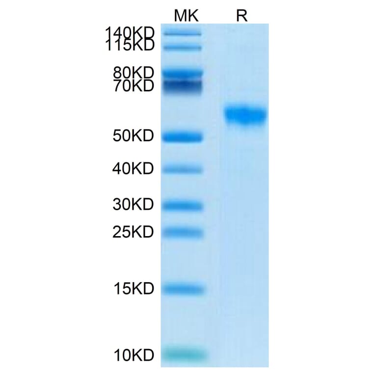 Tris-Bis PAGE - Recombinant Human SIGLEC8 Protein (Biotin) (C-terminal His and Avi Tag) (A331267) - Antibodies.com