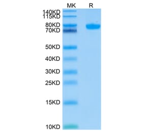 Tris-Bis PAGE - Recombinant Human SIGLEC8 Protein (C-terminal Human Fc Tag) (A331268) - Antibodies.com