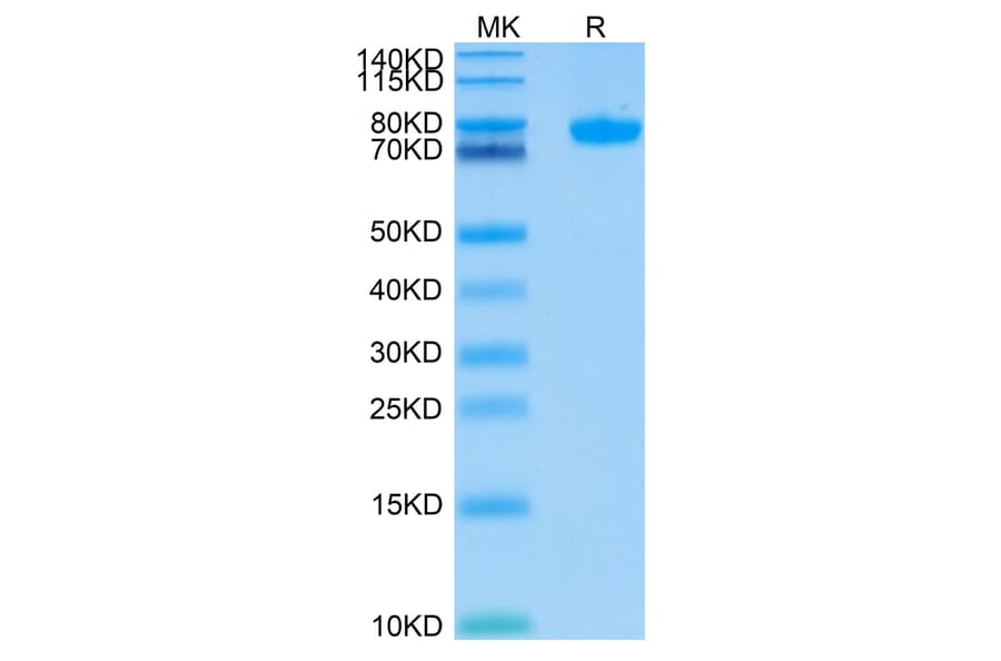 Tris-Bis PAGE - Recombinant Human SIGLEC8 Protein (C-terminal Human Fc Tag) (A331268) - Antibodies.com