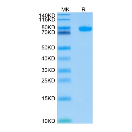 Tris-Bis PAGE - Recombinant Human SIGLEC8 Protein (C-terminal Human Fc Tag) (A331268) - Antibodies.com