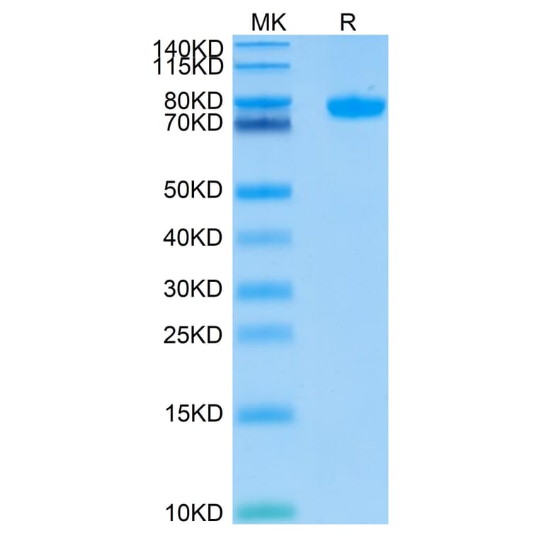 Tris-Bis PAGE - Recombinant Human SIGLEC8 Protein (C-terminal Human Fc Tag) (A331268) - Antibodies.com