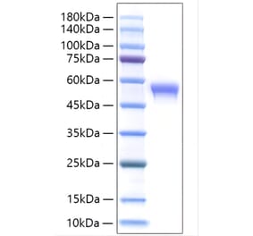 SDS-PAGE - Recombinant Human SIGLEC8 Protein (C-terminal His Tag) (A331269) - Antibodies.com