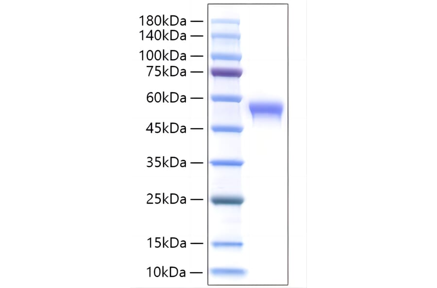 SDS-PAGE - Recombinant Human SIGLEC8 Protein (C-terminal His Tag) (A331269) - Antibodies.com
