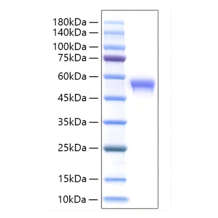 SDS-PAGE - Recombinant Human SIGLEC8 Protein (C-terminal His Tag) (A331269) - Antibodies.com