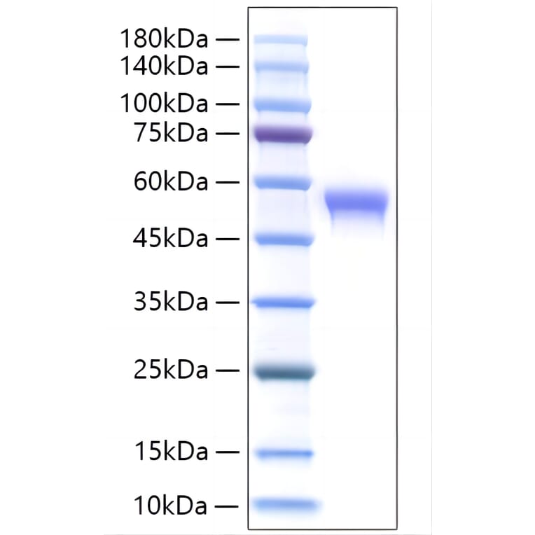 SDS-PAGE - Recombinant Human SIGLEC8 Protein (C-terminal His Tag) (A331269) - Antibodies.com