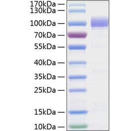 SDS-PAGE - Recombinant Human SIGLEC9 Protein (C-terminal Human Fc and His Tag) (A331270) - Antibodies.com