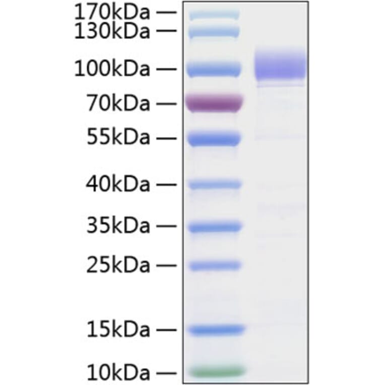 SDS-PAGE - Recombinant Human SIGLEC9 Protein (C-terminal Human Fc and His Tag) (A331270) - Antibodies.com