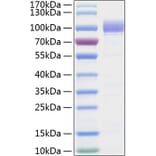 SDS-PAGE - Recombinant Human SIGLEC9 Protein (C-terminal Human Fc and His Tag) (A331270) - Antibodies.com