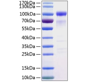 SDS-PAGE - Recombinant Human SIRP alpha Protein (C-terminal Human Fc and His Tag) (A331271) - Antibodies.com