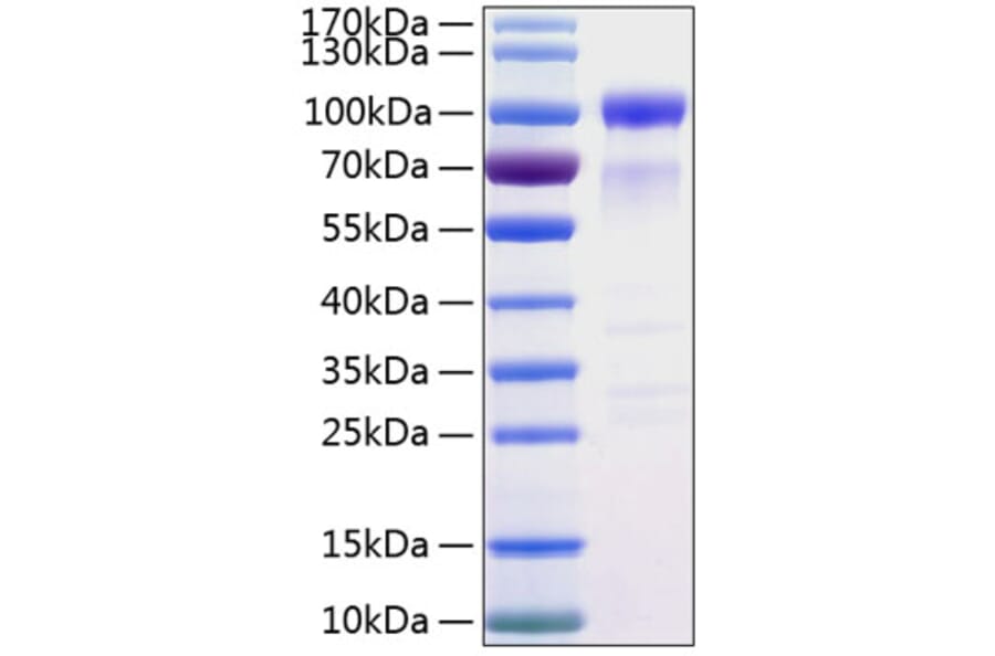 SDS-PAGE - Recombinant Human SIRP alpha Protein (C-terminal Human Fc and His Tag) (A331271) - Antibodies.com