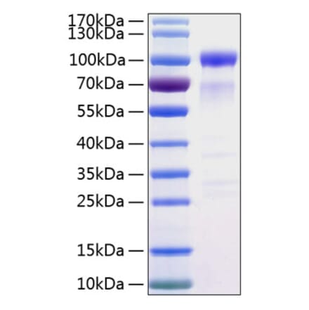 SDS-PAGE - Recombinant Human SIRP alpha Protein (C-terminal Human Fc and His Tag) (A331271) - Antibodies.com