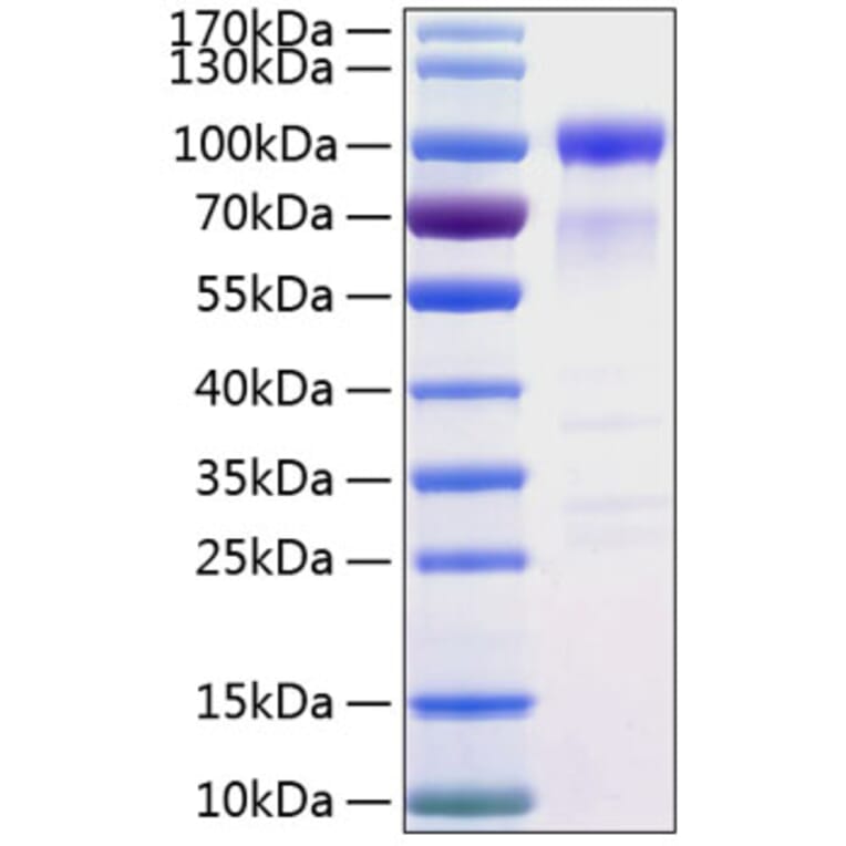 SDS-PAGE - Recombinant Human SIRP alpha Protein (C-terminal Human Fc and His Tag) (A331271) - Antibodies.com