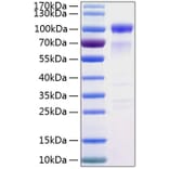 SDS-PAGE - Recombinant Human SIRP alpha Protein (C-terminal Human Fc and His Tag) (A331271) - Antibodies.com