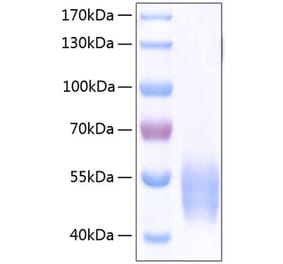 SDS-PAGE - Recombinant Human SIRP alpha Protein (C-terminal His Tag) (A331272) - Antibodies.com