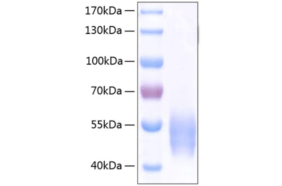SDS-PAGE - Recombinant Human SIRP alpha Protein (C-terminal His Tag) (A331272) - Antibodies.com