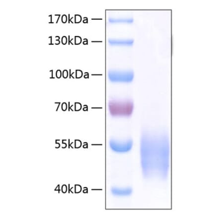 SDS-PAGE - Recombinant Human SIRP alpha Protein (C-terminal His Tag) (A331272) - Antibodies.com