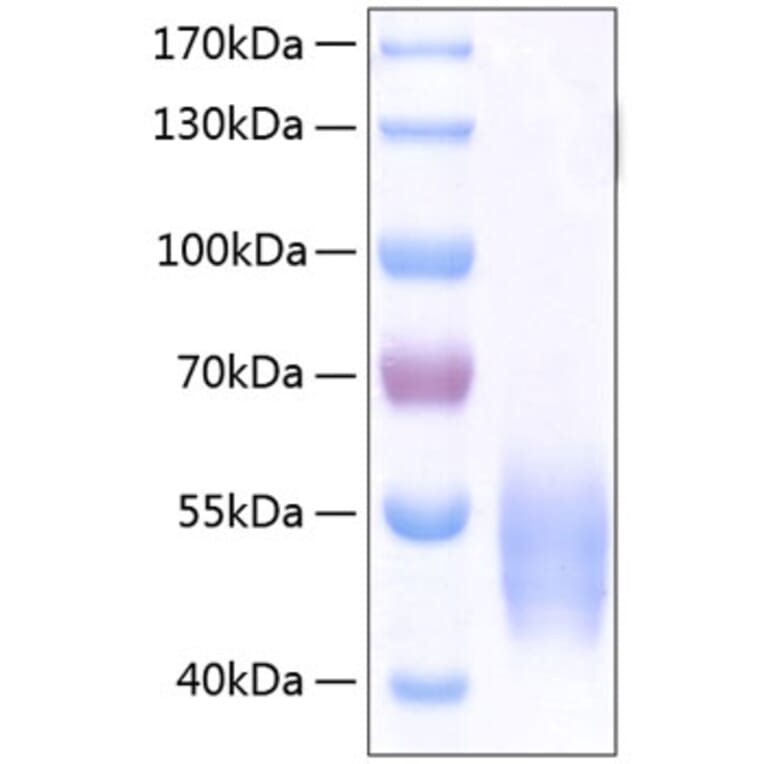 SDS-PAGE - Recombinant Human SIRP alpha Protein (C-terminal His Tag) (A331272) - Antibodies.com