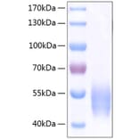 SDS-PAGE - Recombinant Human SIRP alpha Protein (C-terminal His Tag) (A331272) - Antibodies.com