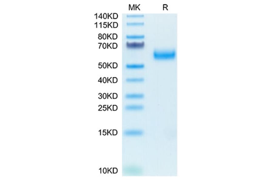 Tris-Bis PAGE - Recombinant Human SIRP alpha Protein (Biotin) (C-terminal His and Avi Tag) (A331273) - Antibodies.com