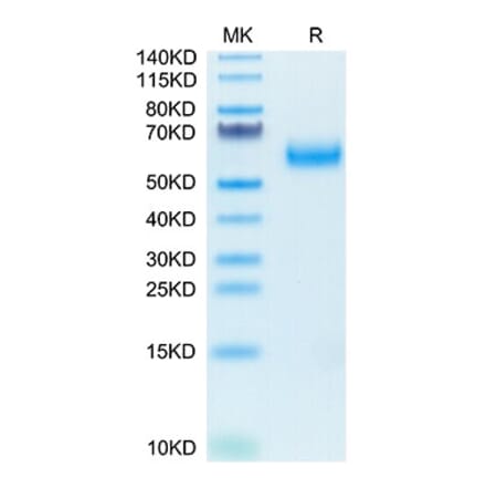Tris-Bis PAGE - Recombinant Human SIRP alpha Protein (Biotin) (C-terminal His and Avi Tag) (A331273) - Antibodies.com
