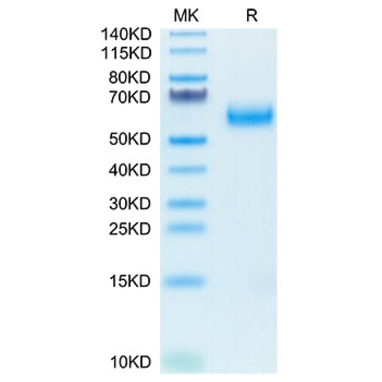 Tris-Bis PAGE - Recombinant Human SIRP alpha Protein (Biotin) (C-terminal His and Avi Tag) (A331273) - Antibodies.com