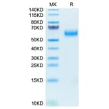 Tris-Bis PAGE - Recombinant Human SIRP alpha Protein (Biotin) (C-terminal His and Avi Tag) (A331273) - Antibodies.com