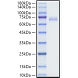 SDS-PAGE - Recombinant Human SLAM / CD150 Protein (C-terminal Human Fc Tag) (A331274) - Antibodies.com