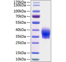 SDS-PAGE - Recombinant Human SLAMF6 Protein (C-terminal His Tag) (A331275) - Antibodies.com
