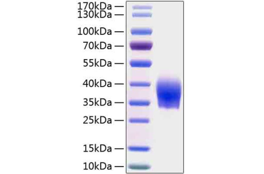 SDS-PAGE - Recombinant Human SLAMF6 Protein (C-terminal His Tag) (A331275) - Antibodies.com