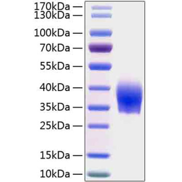 SDS-PAGE - Recombinant Human SLAMF6 Protein (C-terminal His Tag) (A331275) - Antibodies.com