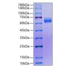 SDS-PAGE - Recombinant Human SLAMF6 Protein (C-terminal Human Fc Tag) (A331276) - Antibodies.com