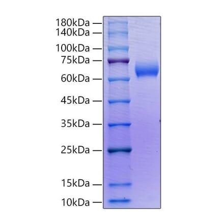 SDS-PAGE - Recombinant Human SLAMF6 Protein (C-terminal Human Fc Tag) (A331276) - Antibodies.com