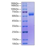 SDS-PAGE - Recombinant Human SLAMF6 Protein (C-terminal Human Fc Tag) (A331276) - Antibodies.com