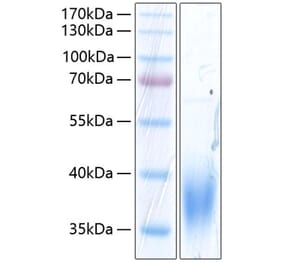 SDS-PAGE - Recombinant Human SLAMF7 Protein (C-terminal His Tag) (A331277) - Antibodies.com