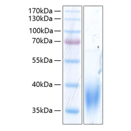 SDS-PAGE - Recombinant Human SLAMF7 Protein (C-terminal His Tag) (A331277) - Antibodies.com