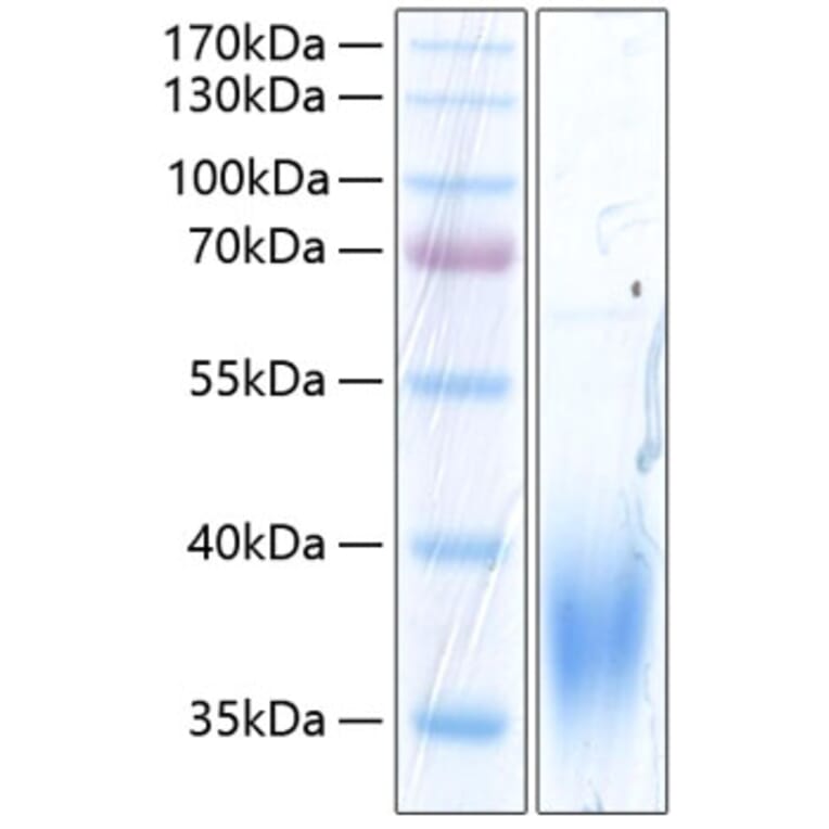 SDS-PAGE - Recombinant Human SLAMF7 Protein (C-terminal His Tag) (A331277) - Antibodies.com