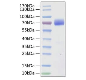 SDS-PAGE - Recombinant Human SLAMF7 Protein (C-terminal Human Fc and His Tag) (A331278) - Antibodies.com