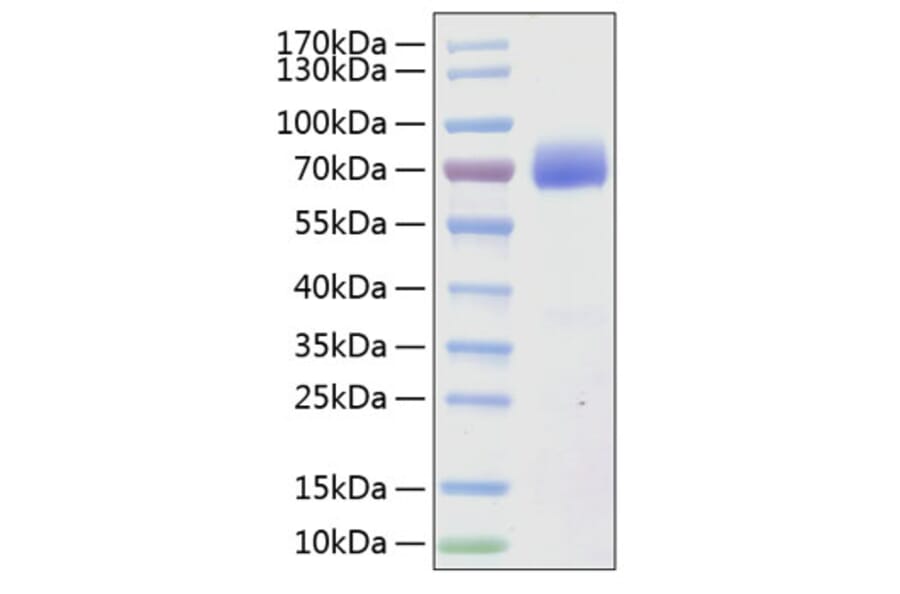 SDS-PAGE - Recombinant Human SLAMF7 Protein (C-terminal Human Fc and His Tag) (A331278) - Antibodies.com