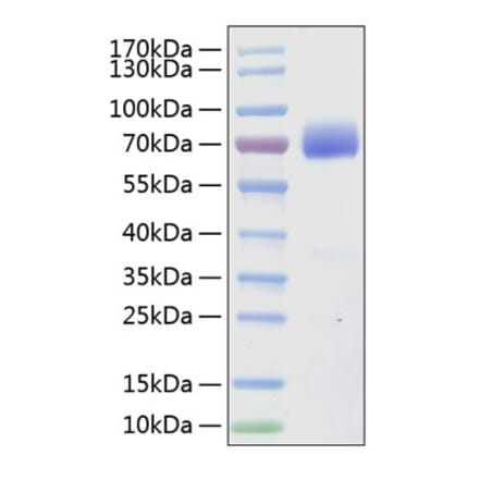 SDS-PAGE - Recombinant Human SLAMF7 Protein (C-terminal Human Fc and His Tag) (A331278) - Antibodies.com