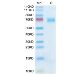 Tris-Bis PAGE - Recombinant Human SLAMF7 Protein (C-terminal Mouse Fc Tag) (A331280) - Antibodies.com