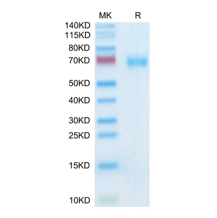 Tris-Bis PAGE - Recombinant Human SLAMF7 Protein (C-terminal Mouse Fc Tag) (A331280) - Antibodies.com