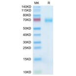 Tris-Bis PAGE - Recombinant Human SLAMF7 Protein (C-terminal Mouse Fc Tag) (A331280) - Antibodies.com