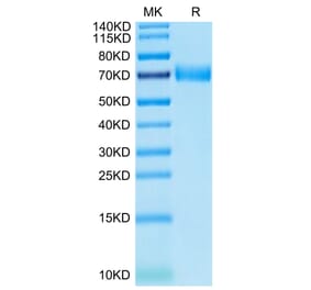 Tris-Bis PAGE - Recombinant Human SLAMF7 Protein (C-terminal Human Fc Tag) (A331281) - Antibodies.com