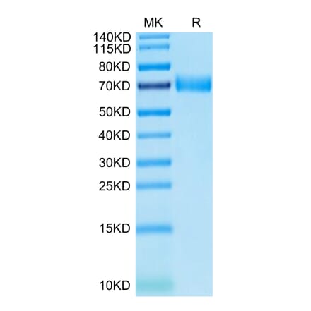 Tris-Bis PAGE - Recombinant Human SLAMF7 Protein (C-terminal Human Fc Tag) (A331281) - Antibodies.com