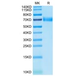 Tris-Bis PAGE - Recombinant Human SLAMF7 Protein (C-terminal Human Fc Tag) (A331281) - Antibodies.com
